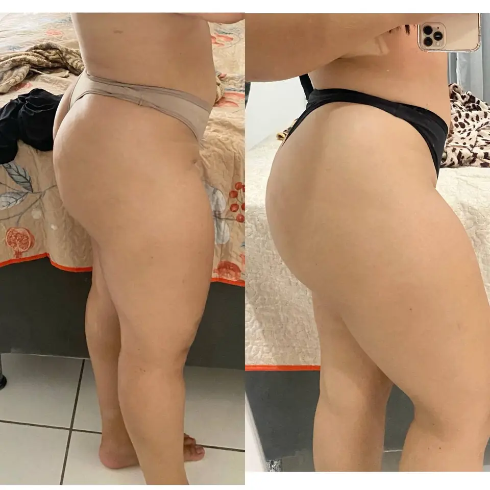 Antes y después de una alumna del método