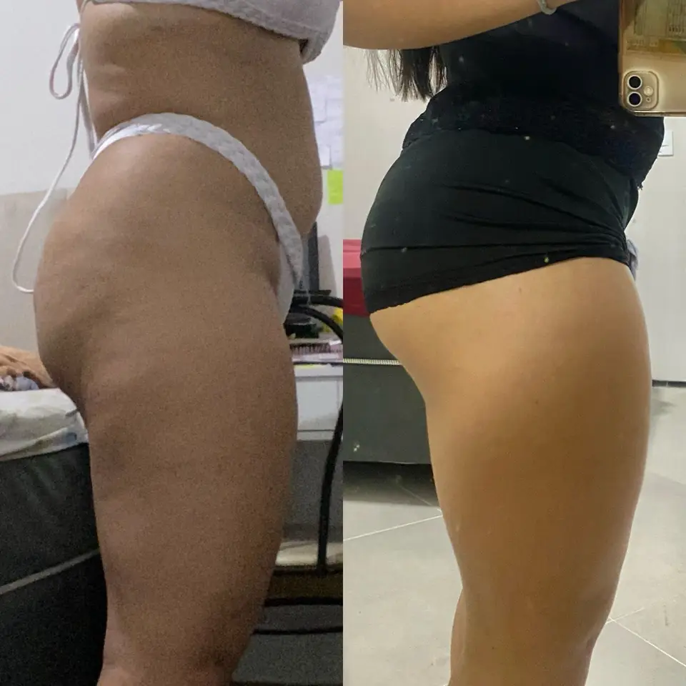 Antes y después de una alumna del método